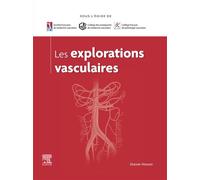 Les explorations vasculaires - Société Française de Médecine Vasculaire - Elsevier Masson - ebook (ePub) - Scolaire / Universitaire