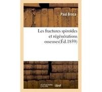 Les fractures spiroïdes et régénérations osseuses Paul Broca (Auteur)