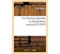 Les fractures spiroïdes et régénérations osseuses - Paul Broca - Hachette Bnf - broché - Livre