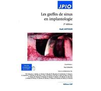Antoun Hadi – Les greffes de sinus en implantologie – 2e édition – Broché