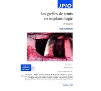 Antoun Hadi – Les greffes de sinus en implantologie – 2e édition – Broché