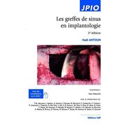Antoun Hadi – Les greffes de sinus en implantologie – 2e édition – Broché