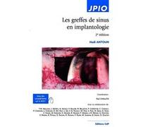 Antoun Hadi – Les greffes de sinus en implantologie – 2e édition – Broché