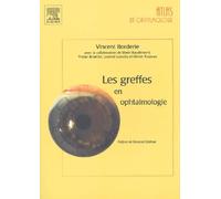 Les greffes en ophtalmologie