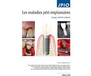 Les maladies péri-implantaires Rodrigo Martin-Cabezas (Auteur)