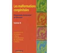 Les Malformations Congénitales - Diagnostic Anténatal Et Devenir Tome 6