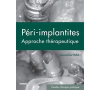 Les péri-implantites Une approche thérapeutique - Amandine Para - Edp Sante-Parresia - broché - Scolaire / Universitaire