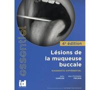 Lésions de la muqueuse buccale: Diagnostic différentiel