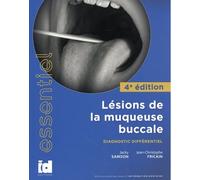 Lésions De La Muqueuse Buccale - Diagnostic Différentiel