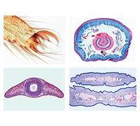 LIEDER Série de micropréparation: invertébrés (Invertebrata), série de base - 25 préparations