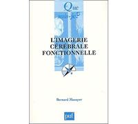 L'Imagerie cérébrale fonctionnelle