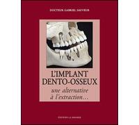 L'implant dento-osseux : une alternative à l'extraction - Gabriel Sauveur - La Simarre - broché - Etude