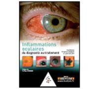 L'inflammation oculaire -de la clinique au traitement - Bahram Bodaghi - Med'com - broché - Scolaire / Universitaire