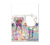 Ling88 Impressions sur Toile,Implant Dentaire Toile Peinture Murale Art Dentaire Affiche Dentiste Anatomie Imprime Médical Mur Art Photos Hôpital Clinique Décoration Affiches Et Impressions - 50X70Cm