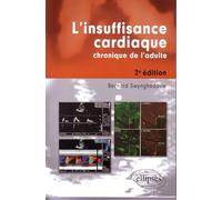 L'insuffisance cardiaque chronique de l'adulte