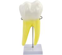 Lipfer Modèle D'anatomie Modèle De Dents Molaires pour L'étude des Maladies Modèle De Dents Modèle De Dent Humaine