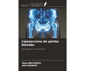 Liposarcoma de partes blandas: Del diagnóstico al tratamiento