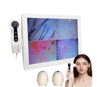 LISTaRSw Analyseur Numérique HD pour Peau & Cheveux -écran 15 Pouces