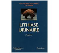 Lithiase Urinaire