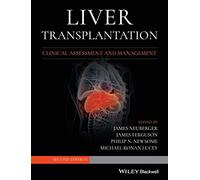 Liver Transplantation: Clinical Assessment and Management