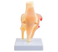 Ljmyy Modèle anatomique de structure de l'articulation du genou en PVC pour l'entraînement clinique et la communication avec les patients