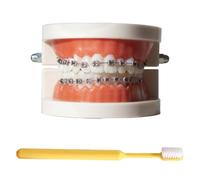 LKYLVEE Modèle de démonstration orthodontique Dentaire Modèle de Traitement des Dents Standard avec Bracket métallique, Fil d'arc explicatif du modèle avec appareils dentaires