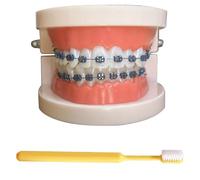 LKYLVEE Modèle de démonstration orthodontique Dentaire Modèle de Traitement des Dents Standard avec Bracket métallique, Fil d'arc explicatif du modèle avec appareils dentaires