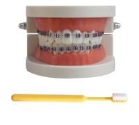 LKYLVEE Modèle de démonstration orthodontique Dentaire Modèle de Traitement des Dents Standard avec Bracket métallique, Fil d'arc explicatif du modèle avec appareils dentaires