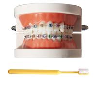 LKYLVEE Modèle de démonstration orthodontique Dentaire Modèle de Traitement des Dents Standard avec Bracket métallique, Fil d'arc explicatif du modèle avec appareils dentaires