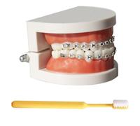 LKYLVEE Modèle de démonstration orthodontique Dentaire Modèle de Traitement des Dents Standard avec Bracket métallique, Fil d'arc explicatif du modèle avec appareils dentaires