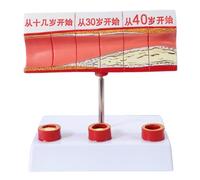 LKYLVEE Modèle de grossissement des vaisseaux sanguins Humains Modèle de Thrombus Modèle de Vaisseau sanguin Athérosclérose Modèle de Thrombus Humain,Large Vessel Occlusion,20cm