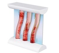 LKYLVEE Modèle de grossissement des vaisseaux sanguins Humains Modèle de Thrombus Modèle de Vaisseau sanguin Athérosclérose Modèle de Thrombus Humain,Dynamic Vessels,20cm