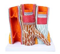 LKYLVEE Modèle de grossissement des vaisseaux sanguins Humains Modèle de Thrombus Modèle de Vaisseau sanguin Athérosclérose Modèle de Thrombus Humain,Arteriovenous Vessels,20cm