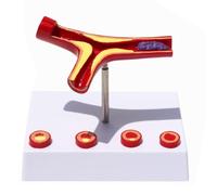 LKYLVEE Modèle de grossissement des vaisseaux sanguins Humains Modèle de Thrombus Modèle de Vaisseau sanguin Athérosclérose Modèle de Thrombus Humain,Fork Shaped Vessels,20cm