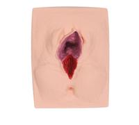 LKYLVEE Modèle de Pratique de Suture périnéale par Incision de la vulve féminine, simulateur d'entraînement à la Suture de la vulve, simulateur de Pratique