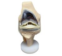 LKYLVEE Modèle Flexible d'articulation du Genou - Modèle de ménisque de Remplacement Total du Genou - pour l'apprentissage et l'enseignement médicaux,Blanc,15cm