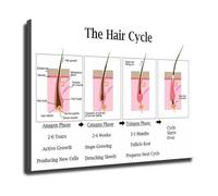 LLBOGRGGN Hair Growth Cycle Chart - Canvas Wall-Art of Follicle Structure and Phases - Educational Poster for Salon and Dermatology Clinic(Framed,08x12inch(20x30cm))