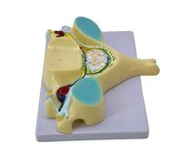 Lodoot Cinquième modèle de colonne cervicale modèle d'os humain modèle médical modèle de transection de la moelle épinière élargie avec médulla spinale