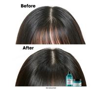 L'ORÉAL PROFESSIONNEL Serie Expert Scalp Advanced Anti-Oiliness 2-in-1 Clay 250 ml