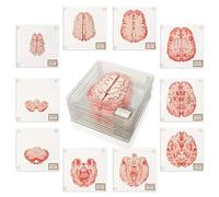 Lot de 10 dessous de verre 3D en forme de spécimen de cerveau pour Halloween, dessous de verre en acrylique drôle pour neurosciences, étudiants en médecine, scientifiques, anatomie humaine, cadeau de