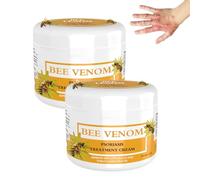 Lot de 2 crèmes de traitement du venin d'abeille pour le psoriasis, le venin d'abeille, le psoriasis, crème de traitement du venin d'abeille néo-zélandais, crème au miel et au psoriasis, 30 g