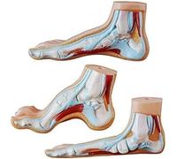 Lot de 3 modèles de pathologie de la voûte plantaire humaine, modèle anatomique avec pied normal, plat et haut for l'enseignement médical en classe