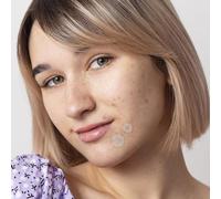 Lot de 30 patchs pour boutons Pimple invisibles pour l'acné hydrocolloïde avec des extraits naturels contre les impuretés de la peau - Testé dermatologiquement