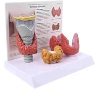 Lot de 4 modèles anatomiques de la thyroïde, anatomie humaine | Maladies thyroïdiennes, étude illustrée du système digestif - Outil pédagogique sur le corps humain