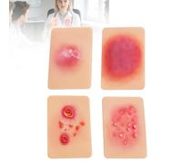 Lot de 4 modèles d'infections cutanées, modèle de plaie infectée par des bactéries, simulateur de méchage de plaies pour la formation médicale, outil de démonstration des soins de plaies