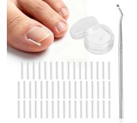 Lot de 50 correcteurs de traitement des ongles incarnés, kit professionnel sans douleur pour ongles incarnés, avec élévateur, bande pour ongles d'orteils pour homme et femme, outil facile à fixer pour