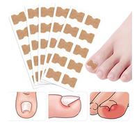 Lot de 50 patchs de correction des ongles incarnés sans colle pour ongles d'orteils pour soins des pieds, autocollants de correction des ongles pour homme et femme