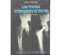 Low Friction Arthroplasty Of The Hip