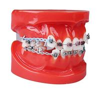 LUCKFY Dentaire Adulte Typodont Démonstration des Dents Modèle avec Dents Supports mentale orthodontiques Modèle avec ligatures Cravate Rouge