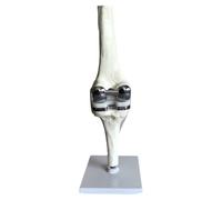 Lumlflc Modèle de simulation d'articulation du genou - Chirurgie de remplacement - Modèle de chirurgie du ménisque, ligament, - Modèle de chirurgie artificielle du genou